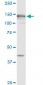 MSH6 Antibody (monoclonal) (M01)